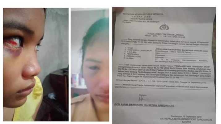 Berlarut-larut kasus penganiayan, ayah Betaria Soneta melaporkan ke polisi pada Senin (16/09/2019). Tampak wajah lebam Beta dan laporan polisi.