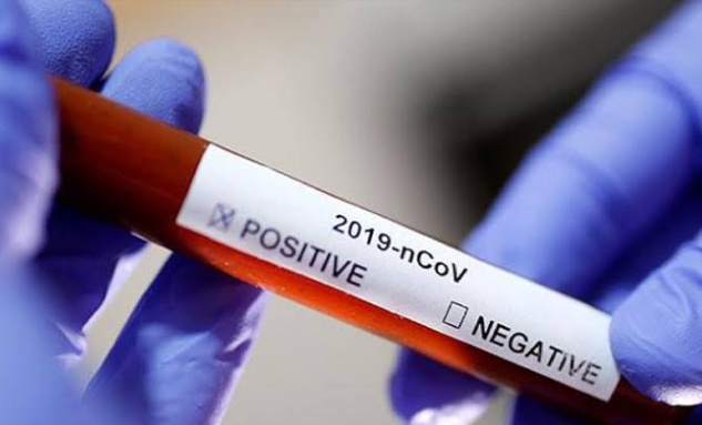 Pasien Positif Virus Corona di Indonesia Bertambah, Saat Ini Sudah 6 Orang