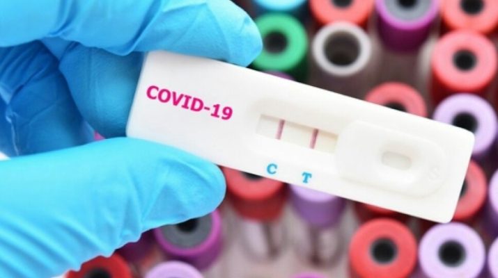 Berbeda dengan kabupaten lain, Sarolangun terbilang aman Virus Corona. Namun hari ini, 3 warga Sarolangun positif hasil Rapid Test.