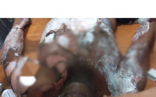 Sadis Ya, Karena Lembu dan Mabuk Tuak, Jumadi Dibakar Istri Mudanya