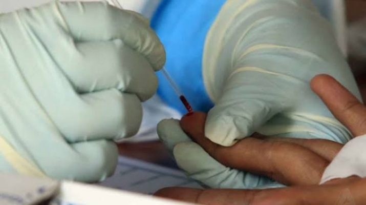 Beredar, Fasha Ikut Uji Swab Bakal Kandidat Gubernur Jambi