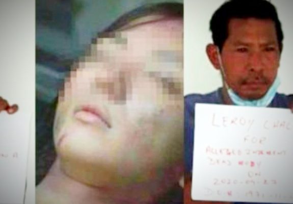 Saking Sangenya, Seorang Pria Nekat Perkosa Mayat Pasien Covid-19