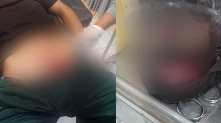 Ngeri dan nyeri dengan aksi pria di Kalimantan ini. Pasalnya, Ia nekad potong titid, lalu masuk dalam toples dan menunjukkan pada istrinya. 